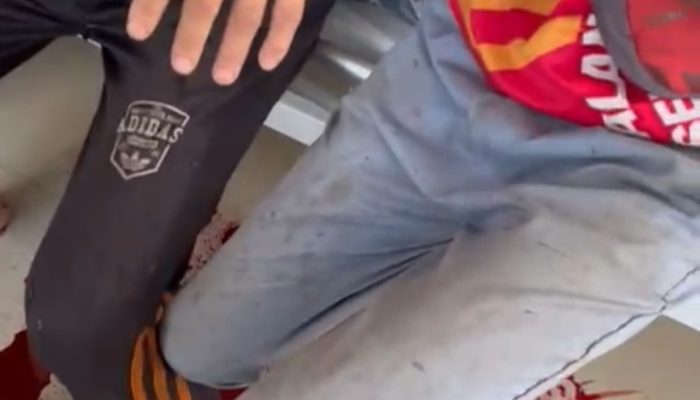 Masyarakat Tani Motaha – Lamoen Diserang Preman dan Bersimbah Darah Diduga Suruhan PT MS “2 Orang Alami Luka Parah”