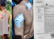 Penganiayaan Berat di Caringin Bogor: Wilson Lalengke Kecam Aksi Main Hakim Sendiri, Desak Polisi Usut Tuntas Terduga Pelaku ‘Imron’